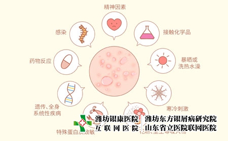 摄图网_401804275_风疹荨麻疹发病原因科普医疗插画（企业商用）