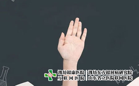 2 (539)