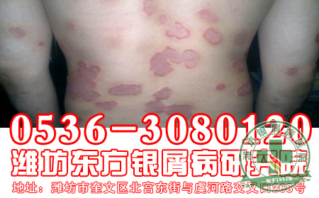  提醒：避免公共场合吸烟