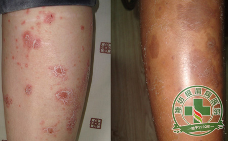 专题报道:考生如何饮食缓解高考压力?