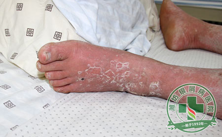 胃癌等20疾病纳入农村大病保障