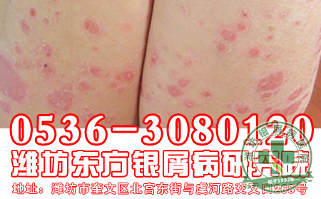 健康的皮肤你值得拥有