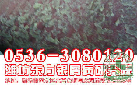 点滴状银屑病都会有什么临床特点呢?