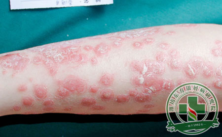 济南银康医院可以不可以?