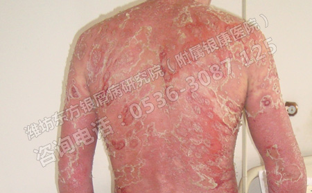 济南银康医院治治疗效果果怎么样呢