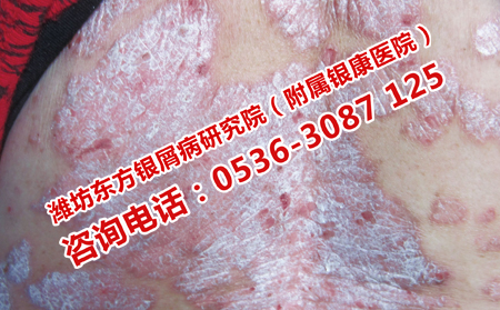 孕妇应该注意什么问题